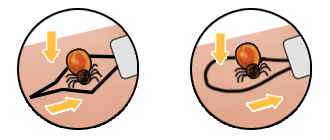 5 Biglietti Per Zecche, Con Lente D'ingrandimento, Per La | FindTheDeal